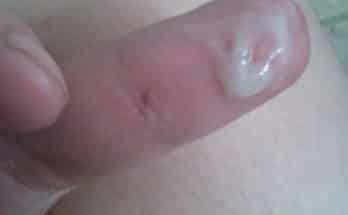 Grool on finger