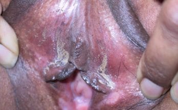 Black pussy with smegma