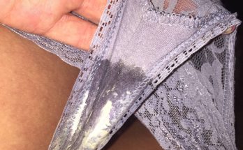 Creamy vaginal discharge on panties 2