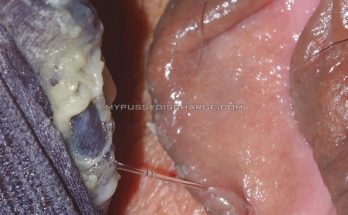 Vaginal discharge on dirty panties close up