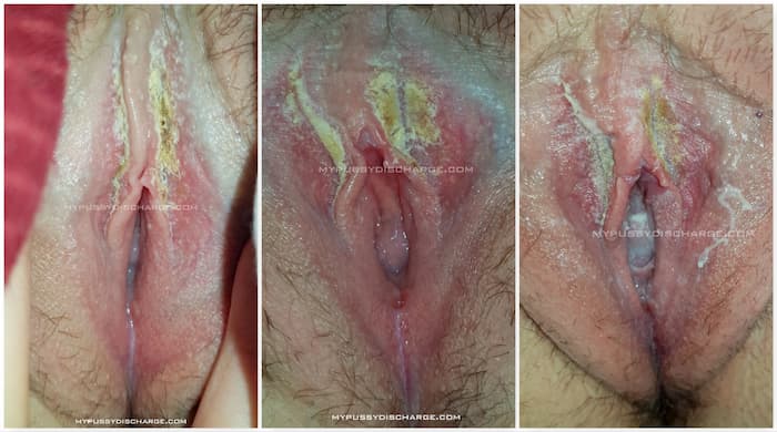 Here's how much vaginal discharge is actually normal