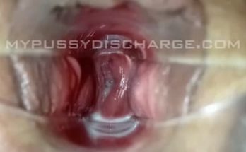Cervix view with creamy discharge using speculum on milf pussy